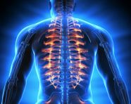 Chronic back pain sciatic nerve, human bone image