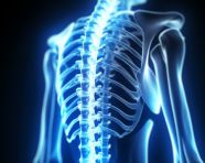 Woman with back pain, human bone image