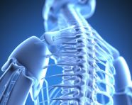 Sufferer of back pain, human bone image