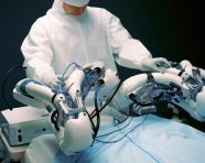 Robotic arms perform surgery inside patient's body, medical images stock